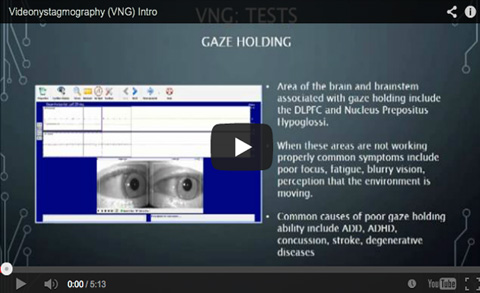 Videonystagmography video screenshot