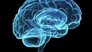X-ray image of a brain