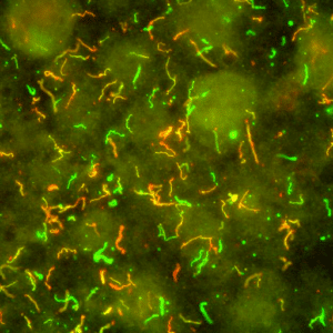 La bacteria de la enfermedad de Lyme es una espiroqueta, lo que significa que se retuerce en espiral