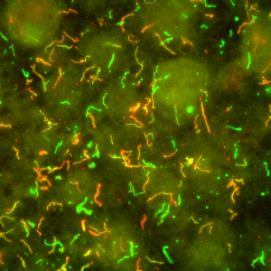 Lyme disease bacterium is a spirochete, which means it is twisted spirally