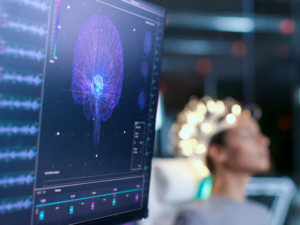 A woman receiving an EEG scan after suffering a traumatic brain injury
