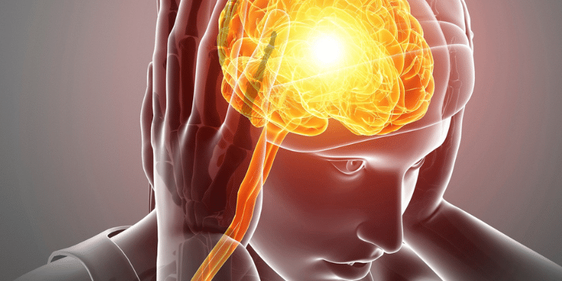 Gráfico del cerebro de un paciente con migrañas crónicas.