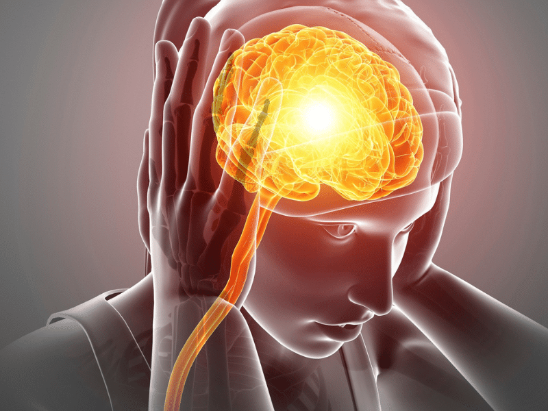 Gráfico del cerebro de un paciente con migrañas crónicas.